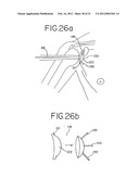 Resurfacing implant for a humeral head diagram and image