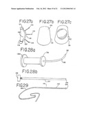 Resurfacing implant for a humeral head diagram and image