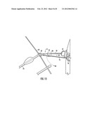 Hands free archery bow support diagram and image