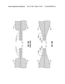 SURGICAL STAPLING INSTRUMENTS INCLUDING A CARTRIDGE HAVING MULTIPLE     STAPLES SIZES diagram and image