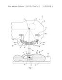 MULTILEAF COLLIMATORS WITH TRANSVERSE MOTION diagram and image