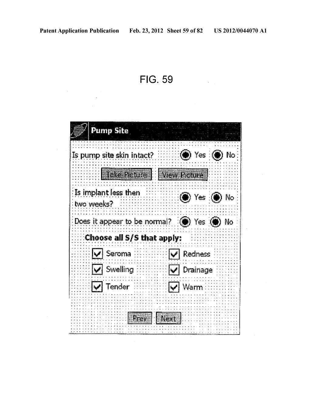 System and Method for Remote Patient Monitoring and Assessment to     Facilitate Patient Treatment - diagram, schematic, and image 60