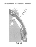 LOCKING DEVICE FOR MOBILE X-RAY SYSTEM diagram and image