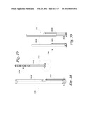 Bale Destacker diagram and image