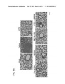 USE OF DEOXYELEPHANTOPIN (DET) AND ANALOGUES THEREOF FOR TREATMENT OF     MELANOMA diagram and image