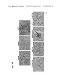 USE OF DEOXYELEPHANTOPIN (DET) AND ANALOGUES THEREOF FOR TREATMENT OF     MELANOMA diagram and image