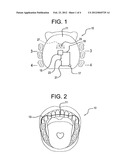 Illuminated orthodontic retainer and case therefor diagram and image