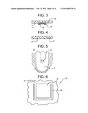 Illuminated orthodontic retainer and case therefor diagram and image