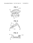 Illuminated orthodontic retainer and case therefor diagram and image