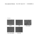 POLY(LACTIC-GLYCOLIC)ACID CROSS LINKED ALENDRONATE (PLGA-ALN) A SHORT TERM     CONTROLLED RELEASE SYSTEM FOR STEM CELL DIFFERENTIATION AND DRUG DELIVERY diagram and image