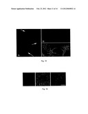 MULTIPOTENT NEURAL STEM CELLS diagram and image