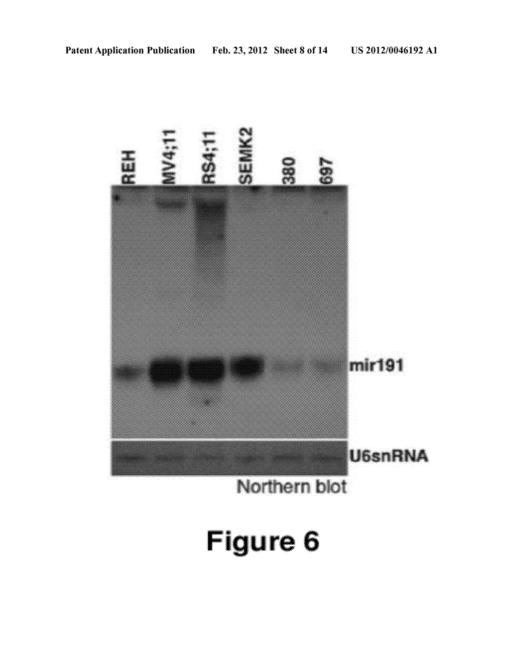 METHOD FOR DIAGNOSING ACUTE LYMPHOMIC LEUKEMIA (ALL) USING MIR-221 - diagram, schematic, and image 09