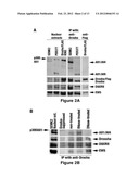 METHOD FOR DIAGNOSING ACUTE LYMPHOMIC LEUKEMIA (ALL) USING MIR-222 diagram and image