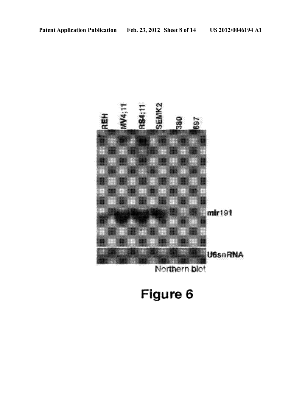 METHOD FOR DIAGNOSING ACUTE LYMPHOMIC LEUKEMIA (ALL) USING MIR-146a - diagram, schematic, and image 09