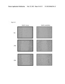 ADRB2 Cancer Markers diagram and image