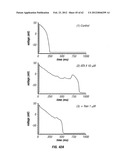 METHOD OF TREATING ARRHYTHMIAS diagram and image