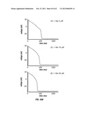 METHOD OF TREATING ARRHYTHMIAS diagram and image