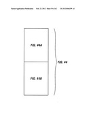 METHOD OF TREATING ARRHYTHMIAS diagram and image