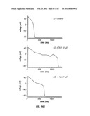 METHOD OF TREATING ARRHYTHMIAS diagram and image