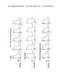 METHOD OF TREATING ARRHYTHMIAS diagram and image