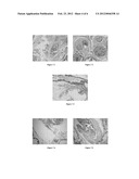 USE OF ISOTHIOCYANATES COMPOUNDS IN TREATING PROSTATIC DISEASES AND SKIN     CANCER diagram and image