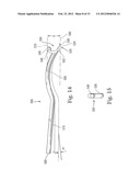 INSTRUMENTS FOR USE IN FEMOROACETABULAR IMPINGEMENT PROCEDURES diagram and image