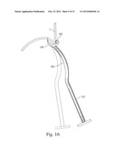 INSTRUMENTS FOR USE IN FEMOROACETABULAR IMPINGEMENT PROCEDURES diagram and image