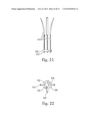 INSTRUMENTS FOR USE IN FEMOROACETABULAR IMPINGEMENT PROCEDURES diagram and image