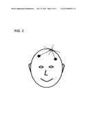 INSERTION OF MEDICAL DEVICES THROUGH NON-ORTHOGONAL AND ORTHOGONAL     TRAJECTORIES WITHIN THE CRANIUM AND METHODS OF USING diagram and image