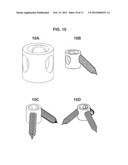 INSERTION OF MEDICAL DEVICES THROUGH NON-ORTHOGONAL AND ORTHOGONAL     TRAJECTORIES WITHIN THE CRANIUM AND METHODS OF USING diagram and image