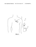 METHOD AND APPARATUS FOR DISTINGUISHING EPILEPTIC SEIZURE AND     NEUROCARDIOGENIC SYNCOPE diagram and image