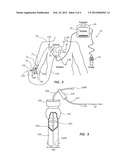 RECONFIRMATION OF ECG-ASSISTED CATHETER TIP PLACEMENT diagram and image