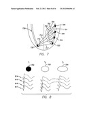 METHODS AND SYSTEMS TO MONITOR AND IDENTIFY TRANSIENT ISCHEMIA diagram and image