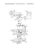 Nerve stimulator measuring device diagram and image