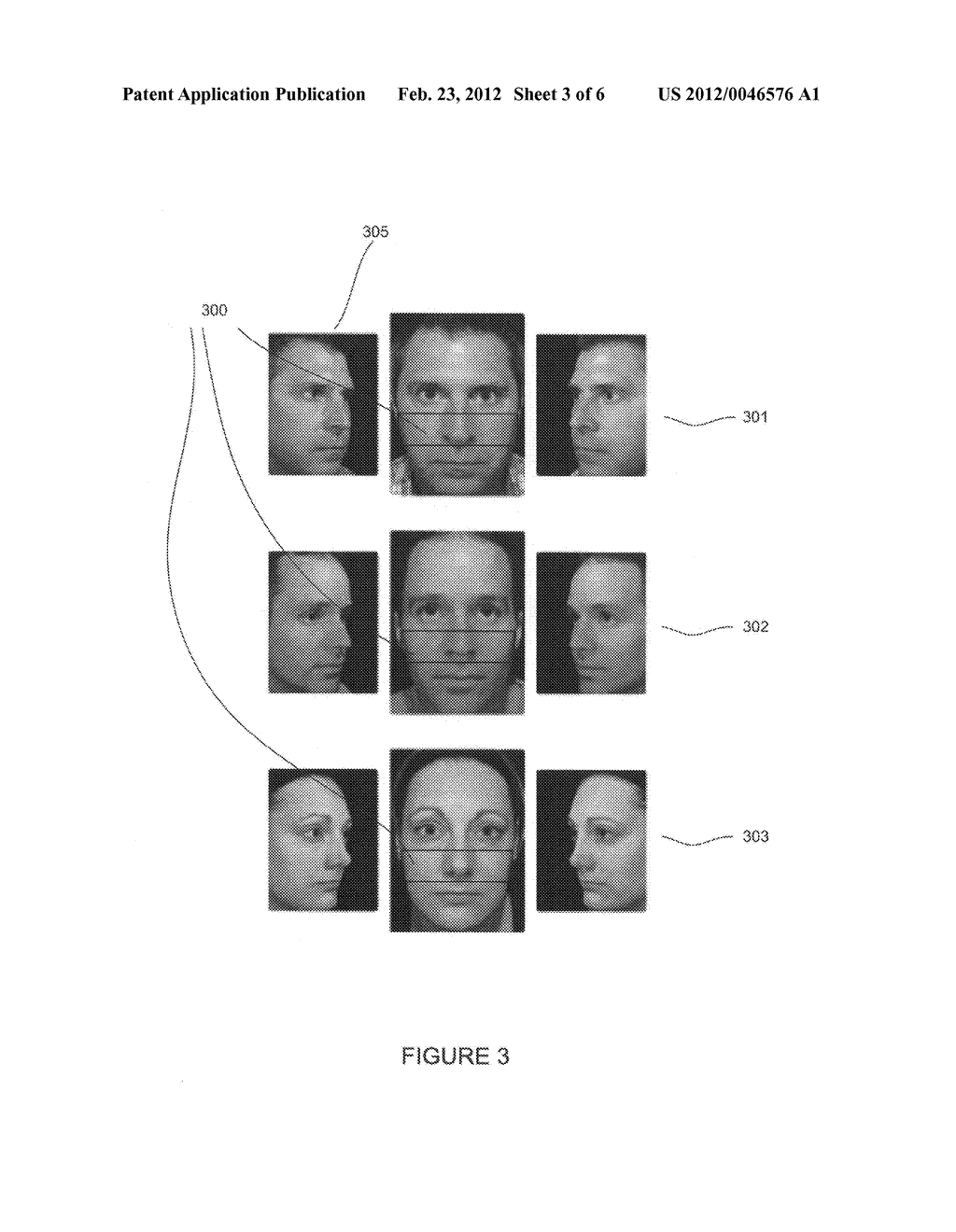 Mid-face aesthetic scale and related methods - diagram, schematic, and image 04