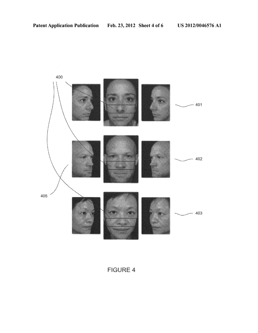 Mid-face aesthetic scale and related methods - diagram, schematic, and image 05