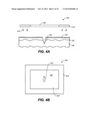 SKIN TREATMENT DEVICES AND METHODS WITH PRE-STRESSED CONFIGURATIONS diagram and image