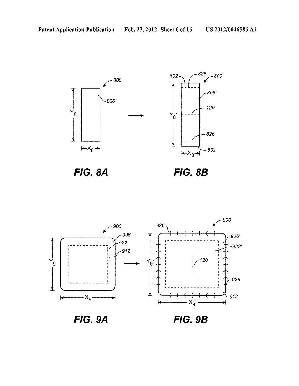 SKIN TREATMENT DEVICES AND METHODS WITH PRE-STRESSED CONFIGURATIONS - diagram, schematic, and image 07