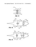 SKIN TREATMENT DEVICES AND METHODS WITH PRE-STRESSED CONFIGURATIONS diagram and image