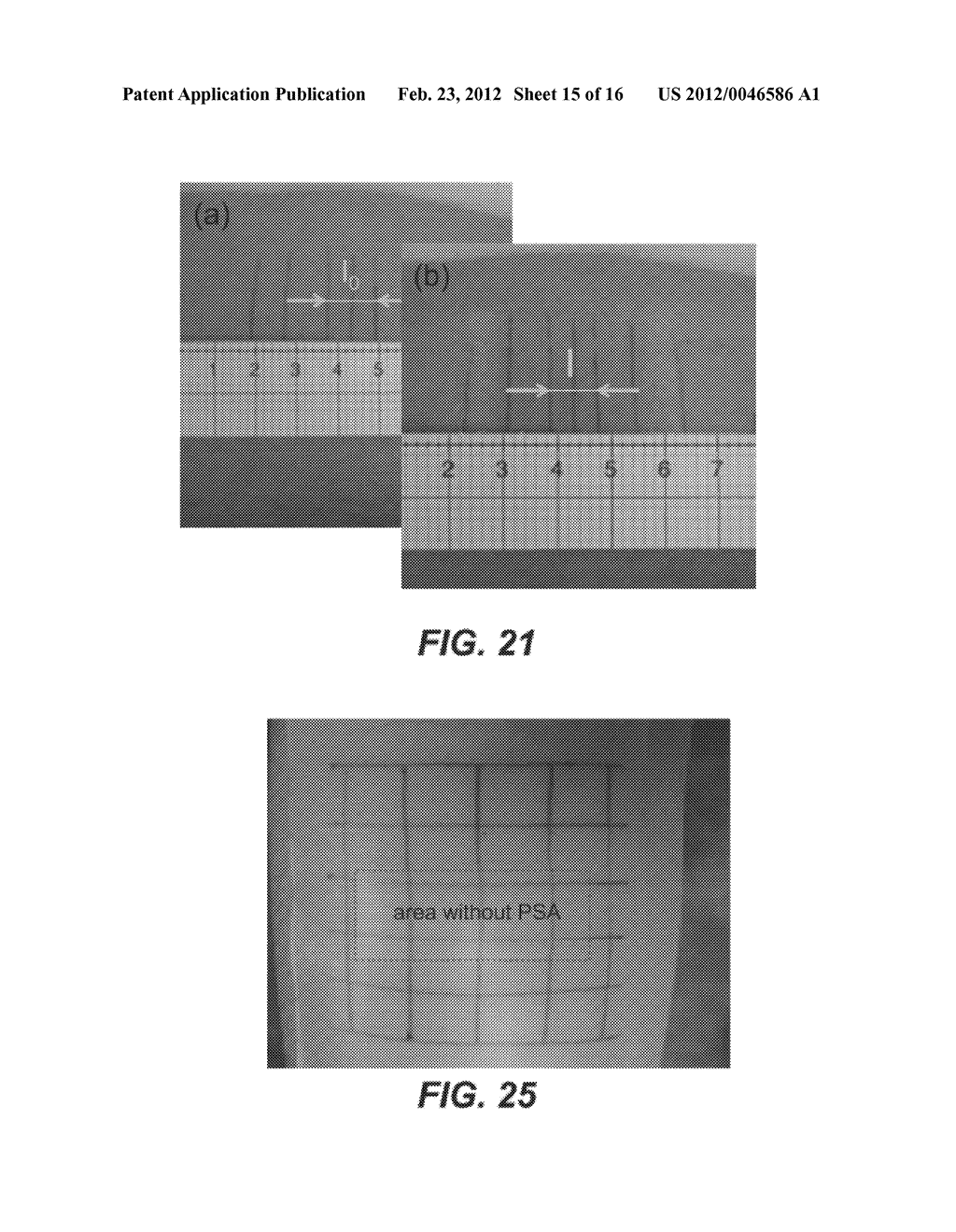 SKIN TREATMENT DEVICES AND METHODS WITH PRE-STRESSED CONFIGURATIONS - diagram, schematic, and image 16