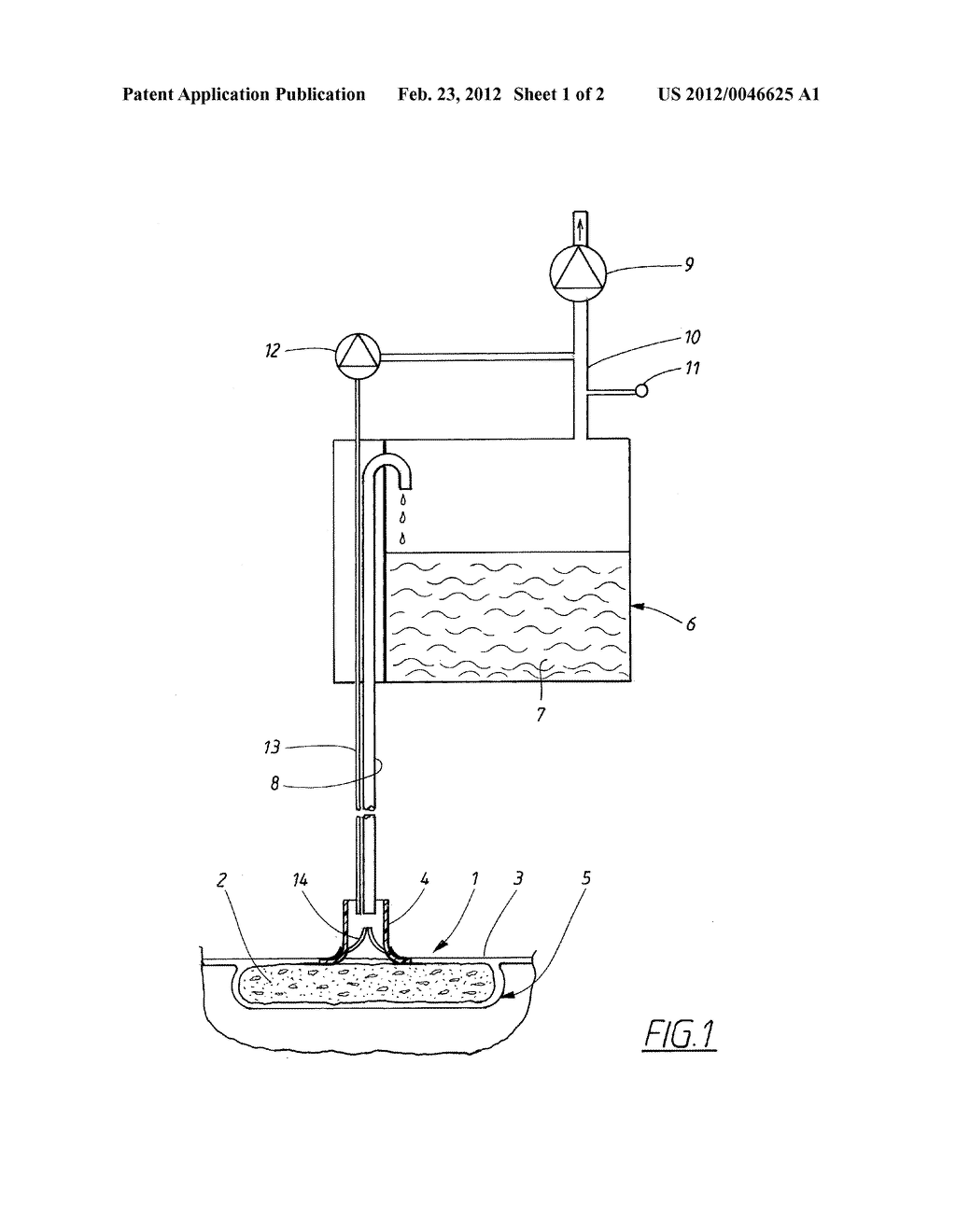 APPARATUS AND METHOD FOR CONTROLLING THE NEGATIVE PRESSURE IN A WOUND - diagram, schematic, and image 02