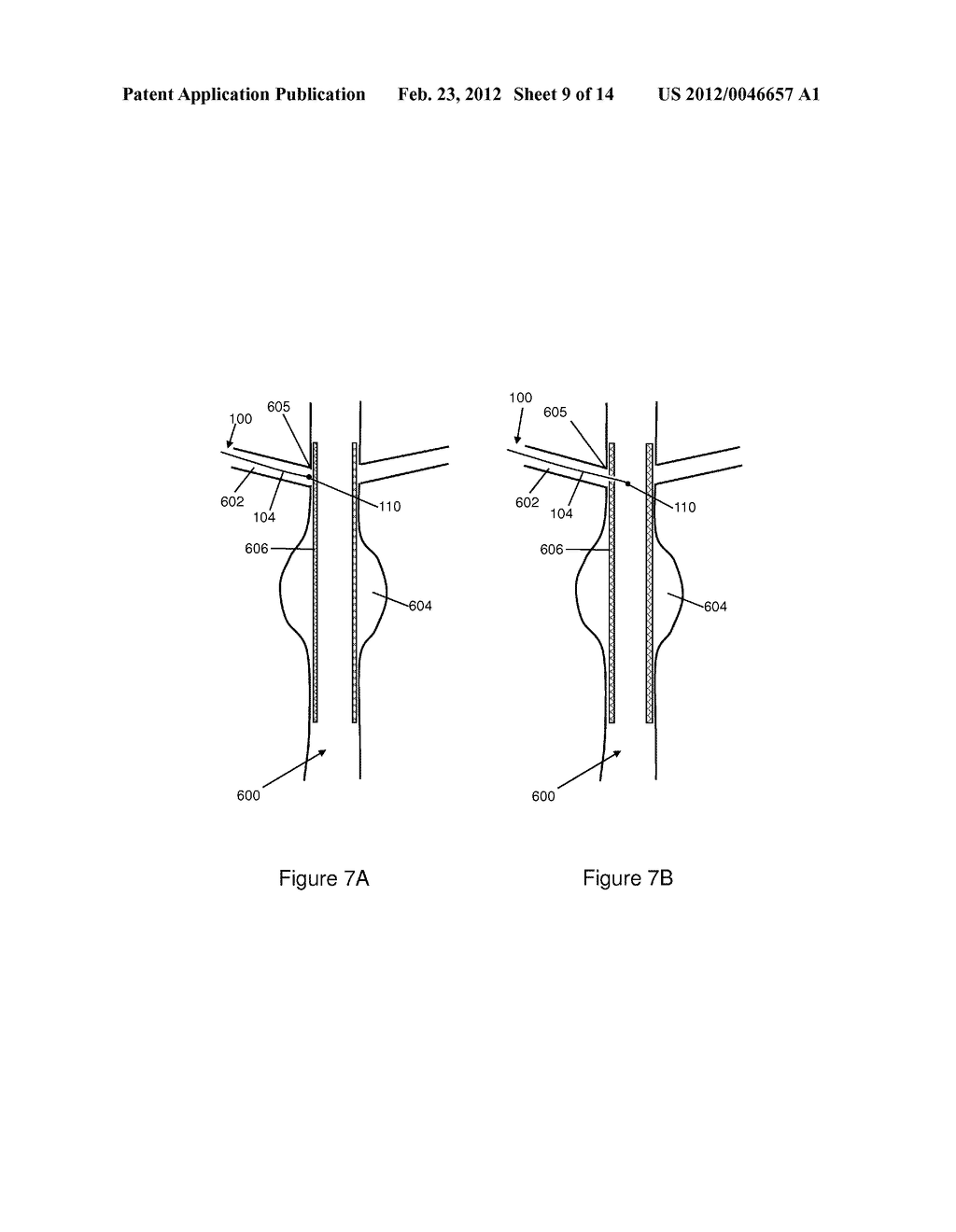 Stent Graft Fenestration - diagram, schematic, and image 10