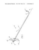 HOLLOW CURVED SUPERELASTIC MEDICAL NEEDLE AND METHOD diagram and image