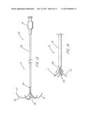 HOLLOW CURVED SUPERELASTIC MEDICAL NEEDLE AND METHOD diagram and image