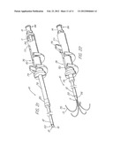 HOLLOW CURVED SUPERELASTIC MEDICAL NEEDLE AND METHOD diagram and image