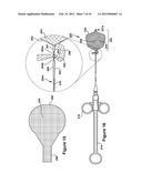 RETRIEVAL DEVICE diagram and image