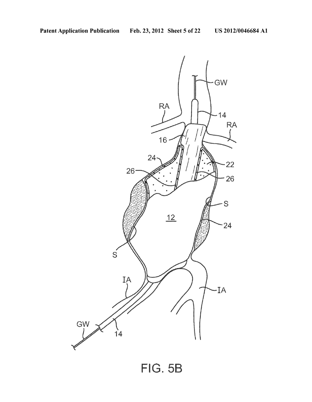 Graft Systems Having Filling Structures Supported by Scaffolds and Methods     for Their Use - diagram, schematic, and image 06