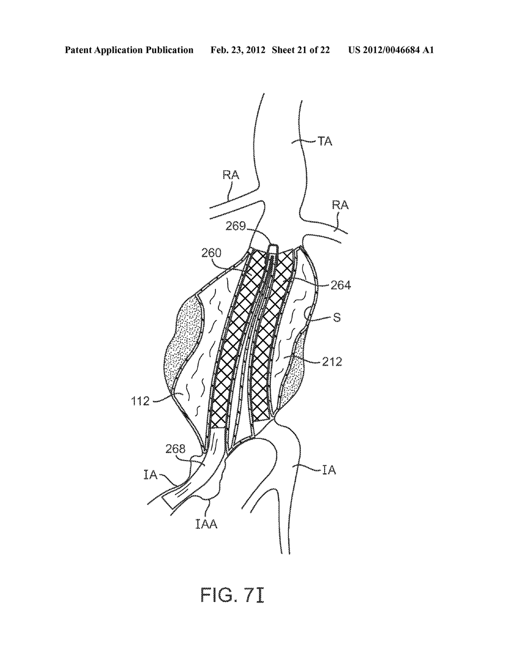 Graft Systems Having Filling Structures Supported by Scaffolds and Methods     for Their Use - diagram, schematic, and image 22