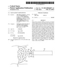 Vascular Occlusion Devices diagram and image