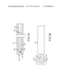 Vascular Occlusion Devices diagram and image